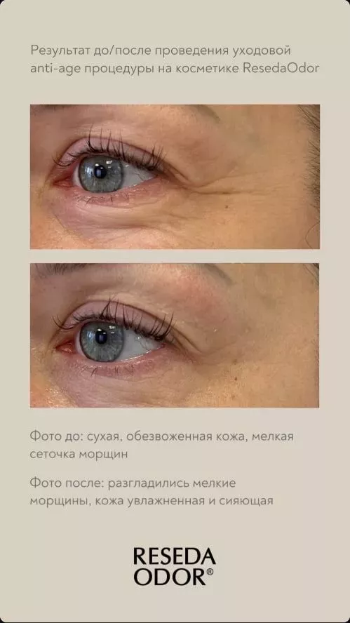 Лифтинг-крем для кожи вокруг глаз. Lifting Eye Cream