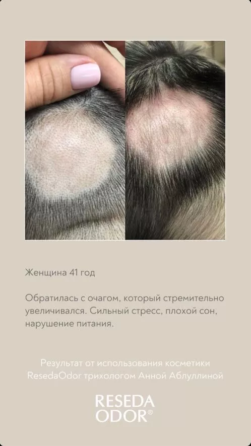 SCC 5 Комплекс для укрепления и восстановления волос. SCC 5 - Strength & Restore Hair Treatment Complex