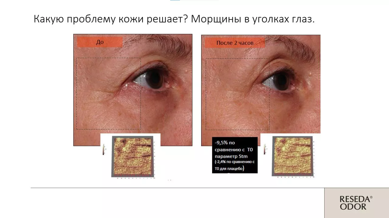Сыворотка омолаживающая "Mio Control". Rejuvenating Serum "Mio Control" (CLINIC)