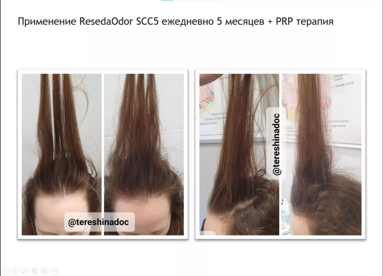 SCC 5 Комплекс для укрепления и восстановления волос. SCC 5 - Strength & Restore Hair Treatment Complex