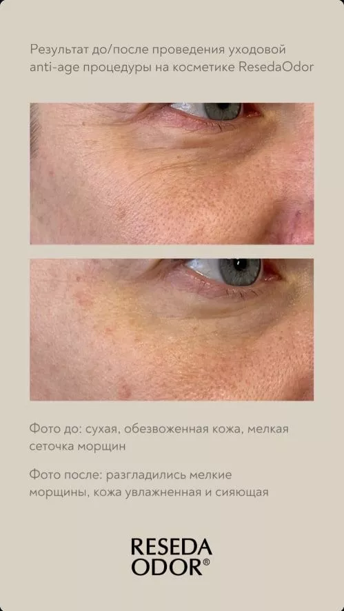 Лифтинг-крем для кожи вокруг глаз. Lifting Eye Cream [Updated Format]