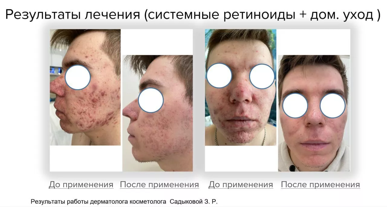 Мягкий очищающий гель Gentle Cleanser Free From Malassezia