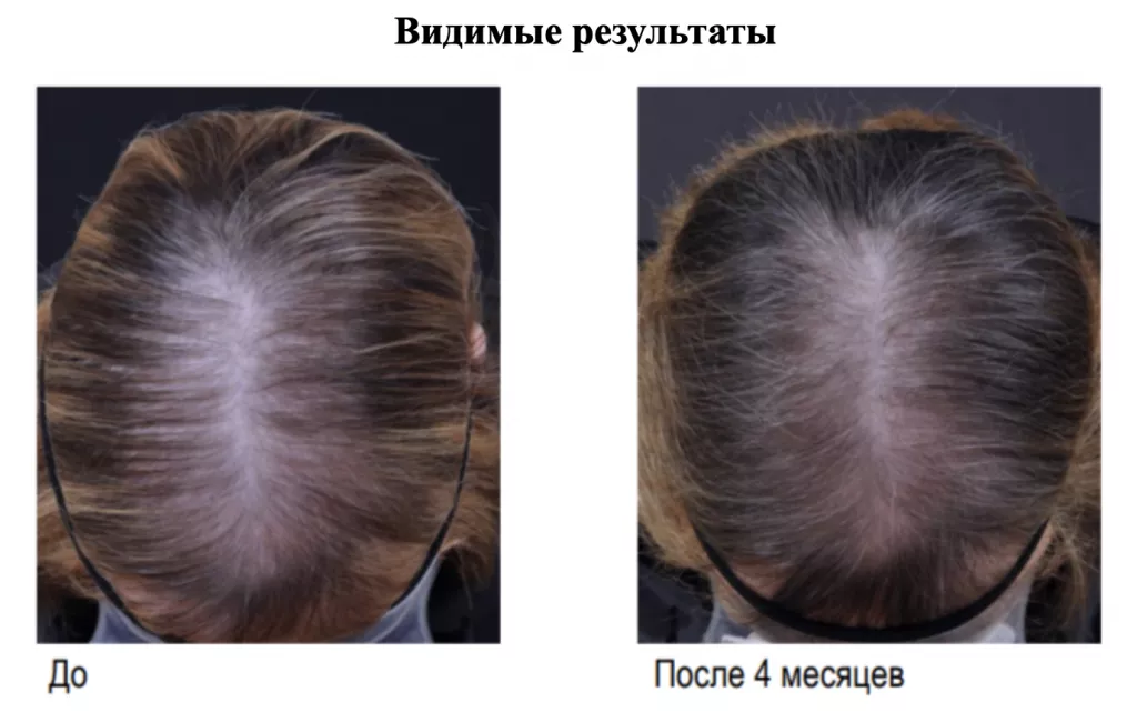 Снимок экрана 2026-02-26 в 21.35.56.png Снимок экрана 2026-02-26 в 21.35.56.png